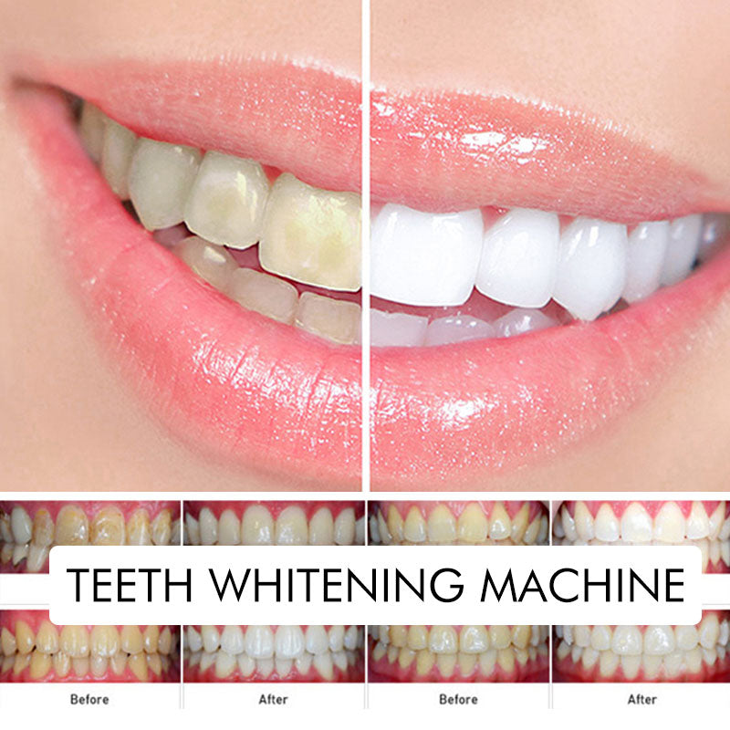 歯科用プロ仕様 ブルーライトホワイトニング機器(テーブルマウント式)