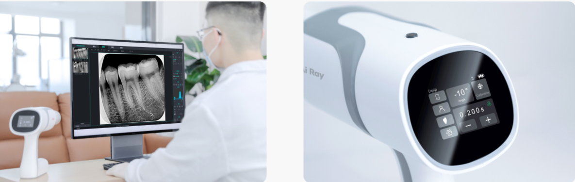 【Woodpecker® Ai Ray 歯科用ポータブルX線装置】日本製高性能X線診断システム
